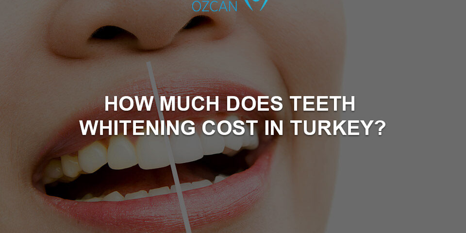 teeth whitening costs in turkey