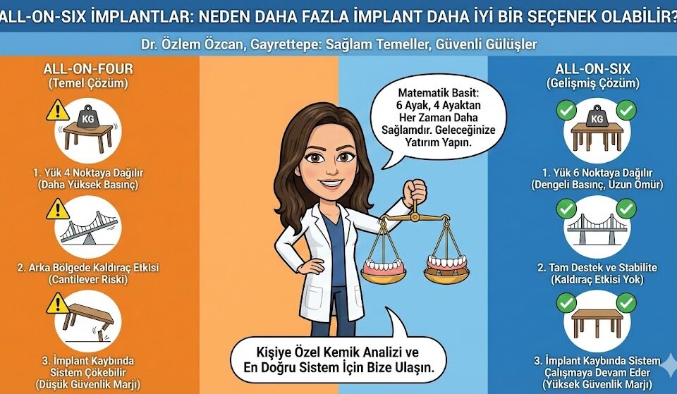 All-on-Six İmplantlar 5 All-on-Six İmplantlar
