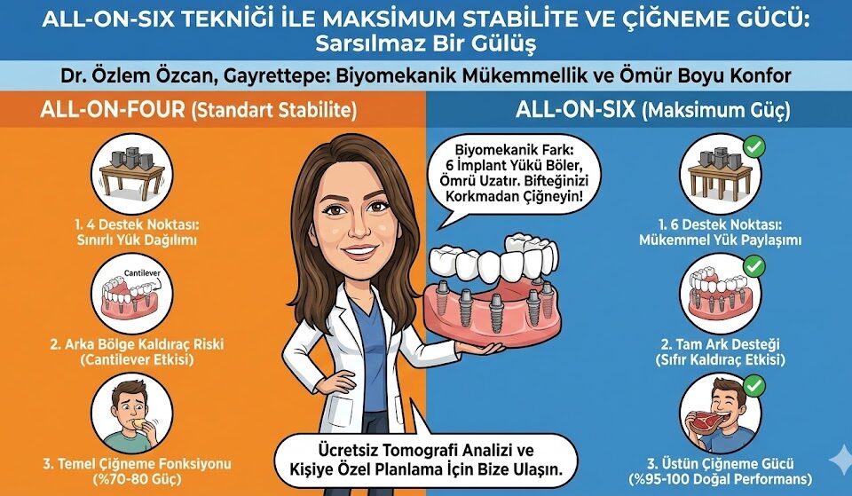 All-on-Six Tekniği ile Maksimum Stabilite ve Çiğneme Gücü 4 All-on-Six Tekniği ile Maksimum Stabilite ve Çiğneme Gücü